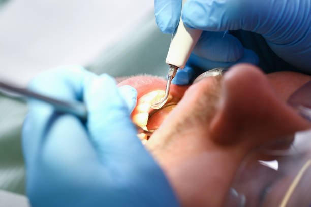 Best Emergency Broken Tooth Repair in Culpeper, VA